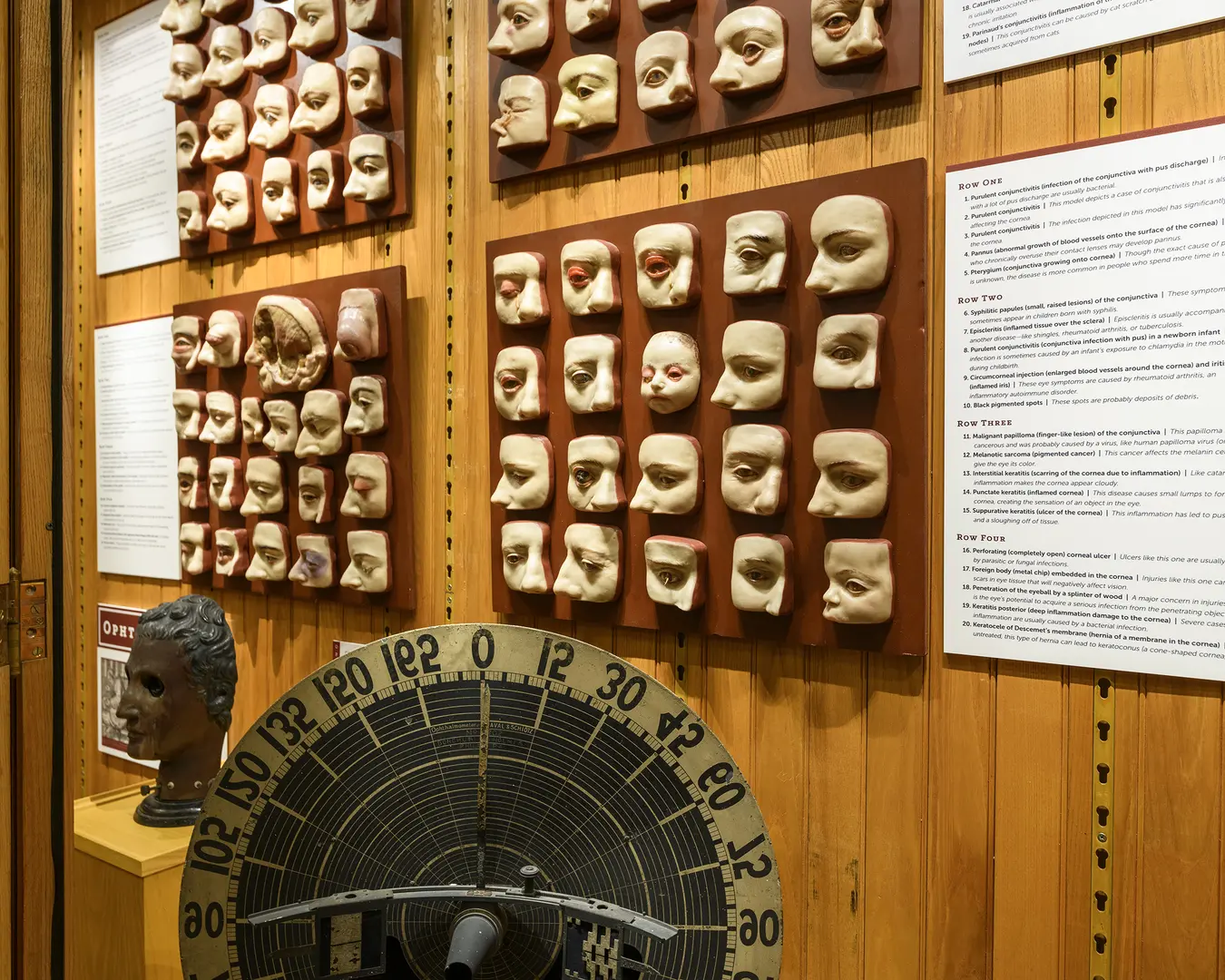 A display of wax models showing various eye conditions used to train physicians at the Mütter Museum. Photo by Constance Mensh.